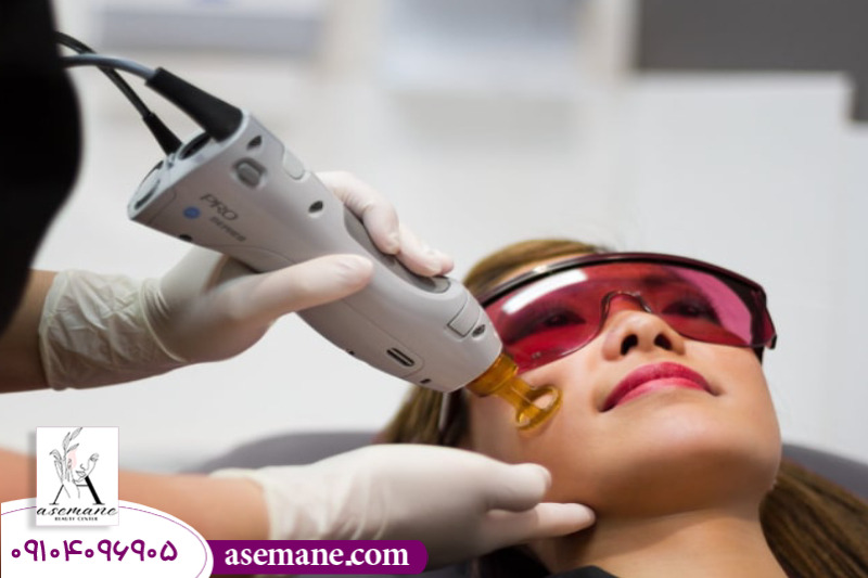 انجام لیزر موهای زائد 